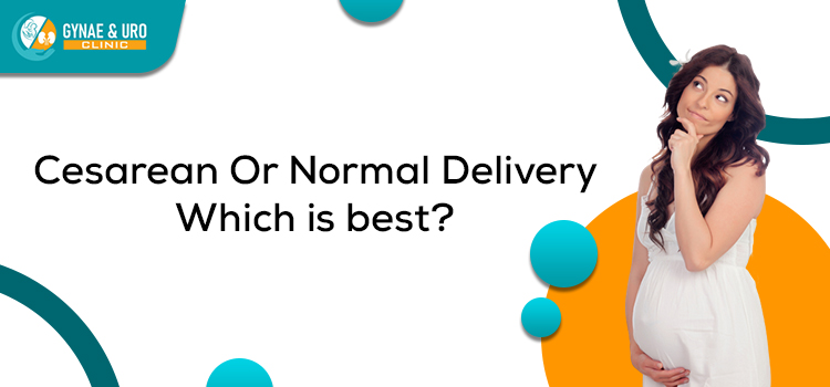 Cesarean or Normal Delivery