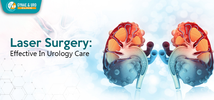 Laser surgery is making a significant mark in urology health care