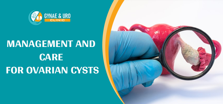 Management and Care For Ovarian Cysts