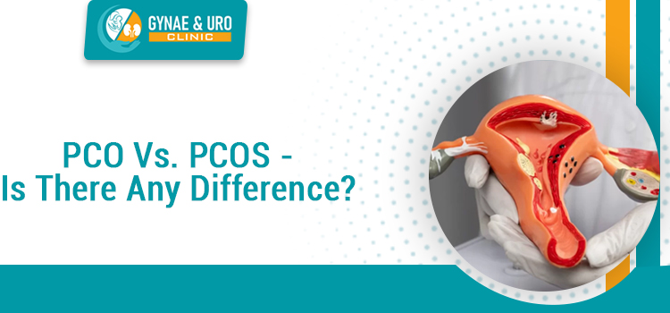 PCO Vs. PCOS - Is There Any Difference