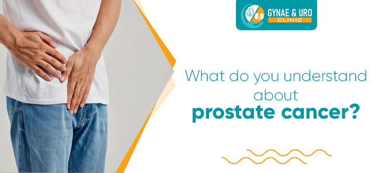 Briefly classify prostate cancer and how it leads to urine leakage?