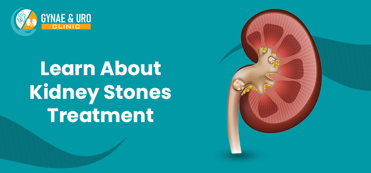 Different Types Of Kidney Stones Treatment And How To Prevent Them?
