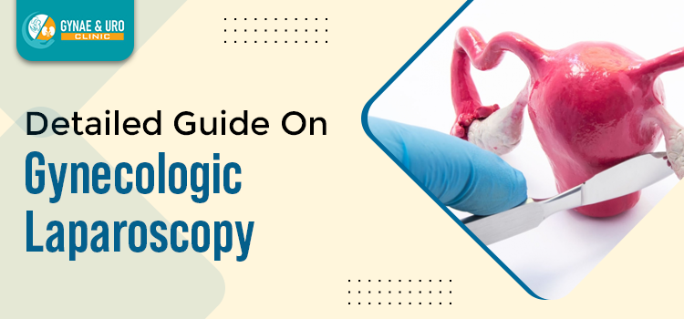 Everything you need to know about the gynecologic laparoscopy